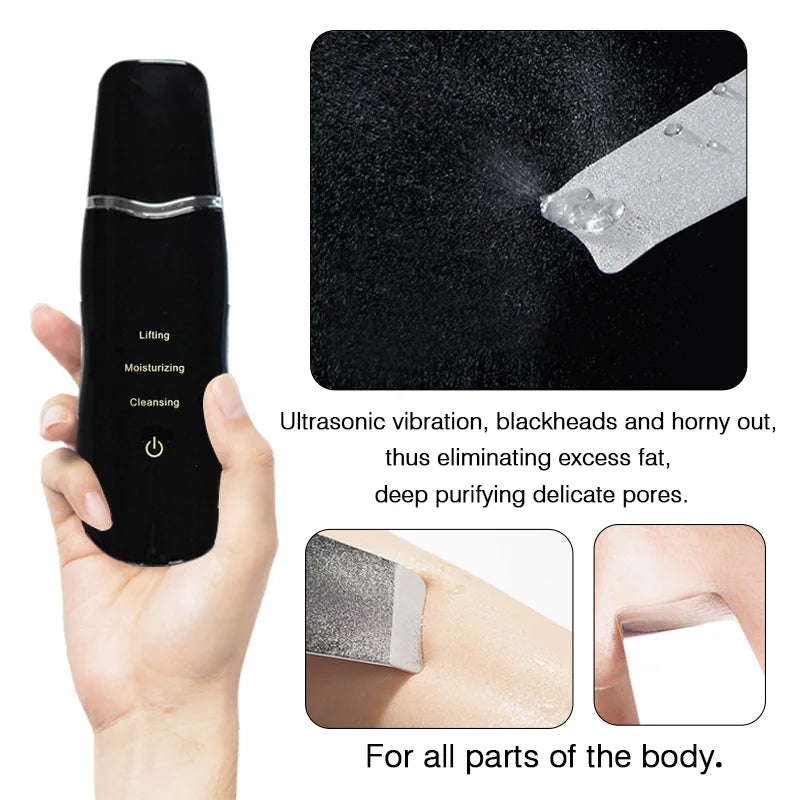 Appareil de Nettoyage Visage Ultrason – Anti-Points Noirs & Anti-Rides