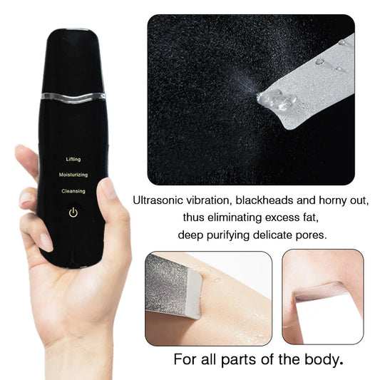 Appareil de Nettoyage Visage Ultrason – Anti-Points Noirs & Anti-Rides